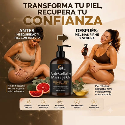 M3 Naturals™ Recupera la seguridad en tu piel y vuelve a sentirte cómoda